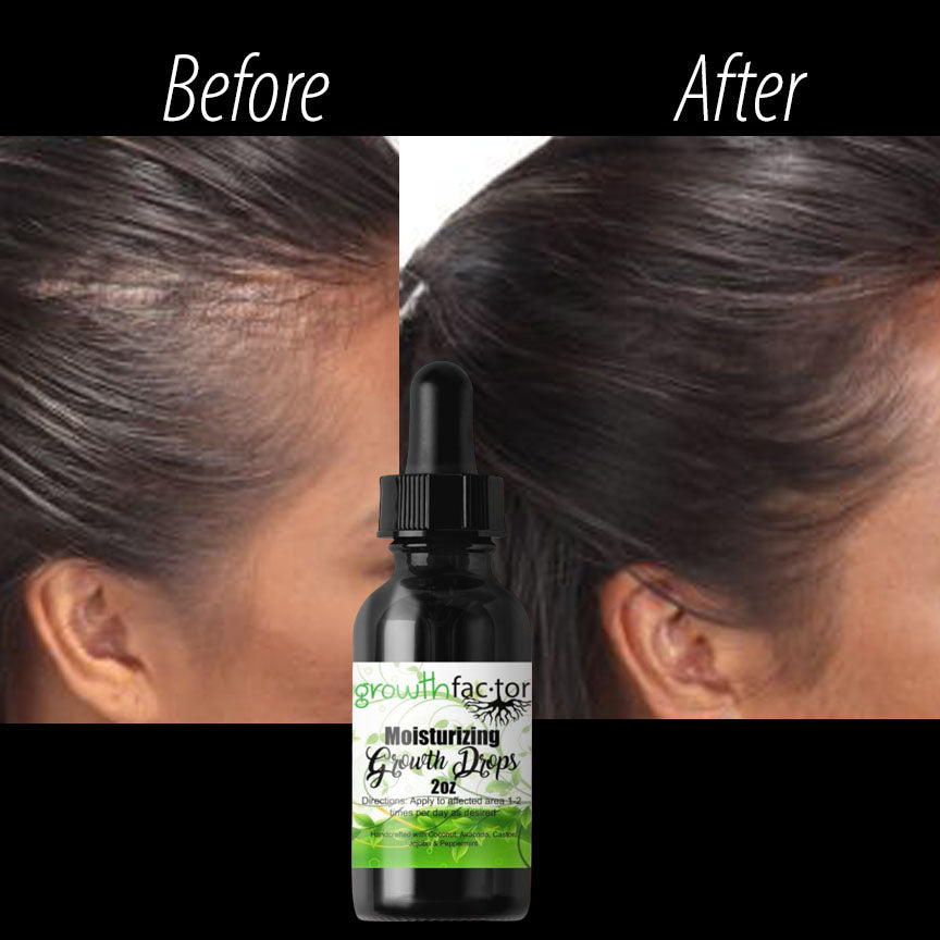 Moisturizing Growth Drops 2oz