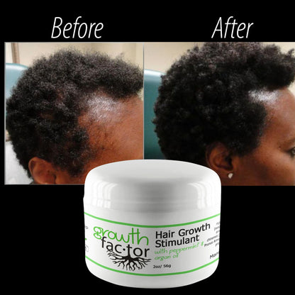Hair Growth Stimulant Cream