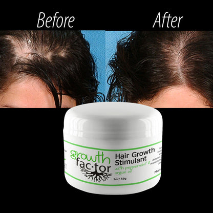 Hair Growth Stimulant Cream